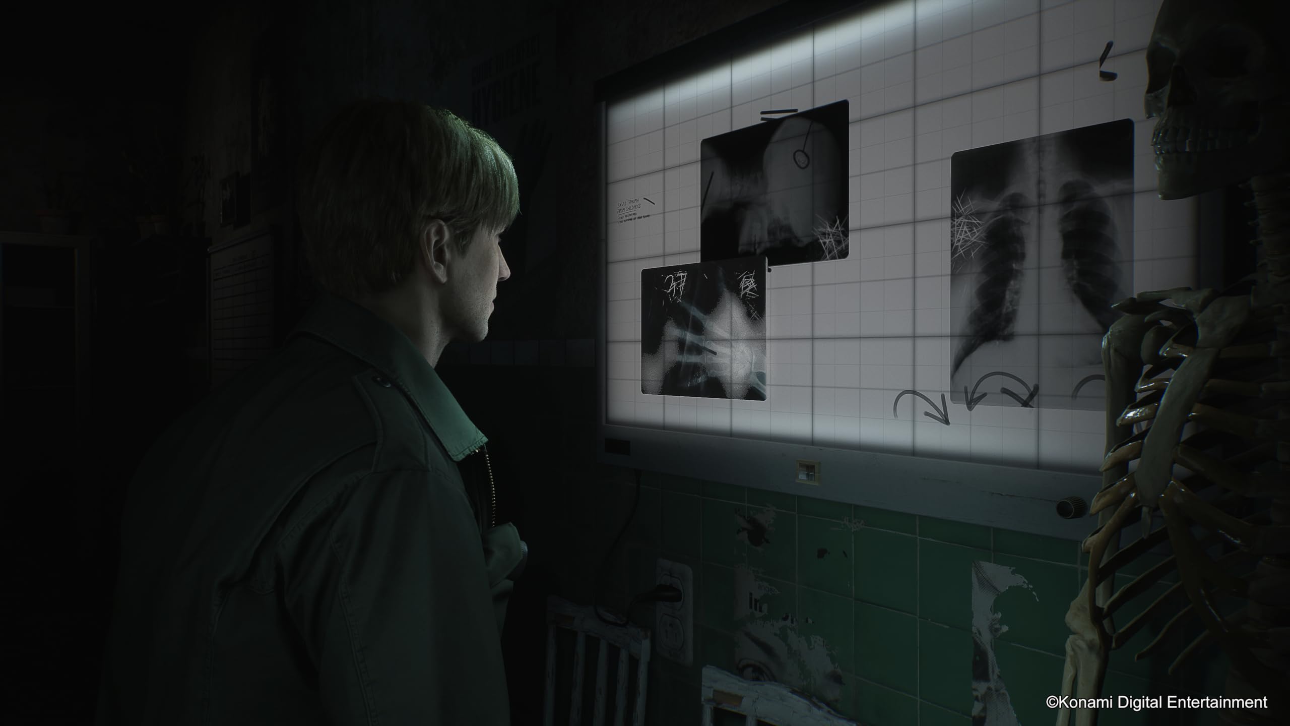 Silent Hill 2 [PS5] 3