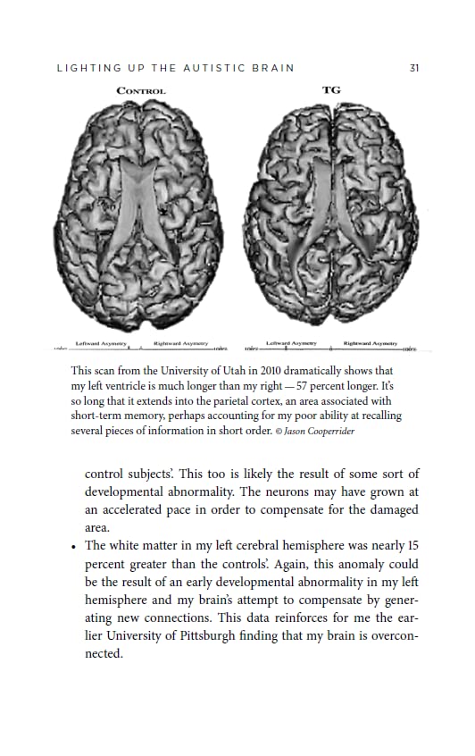 The Autistic Brain: Understanding Autism from a Neurodivergent Perspective by Temple Grandin 7