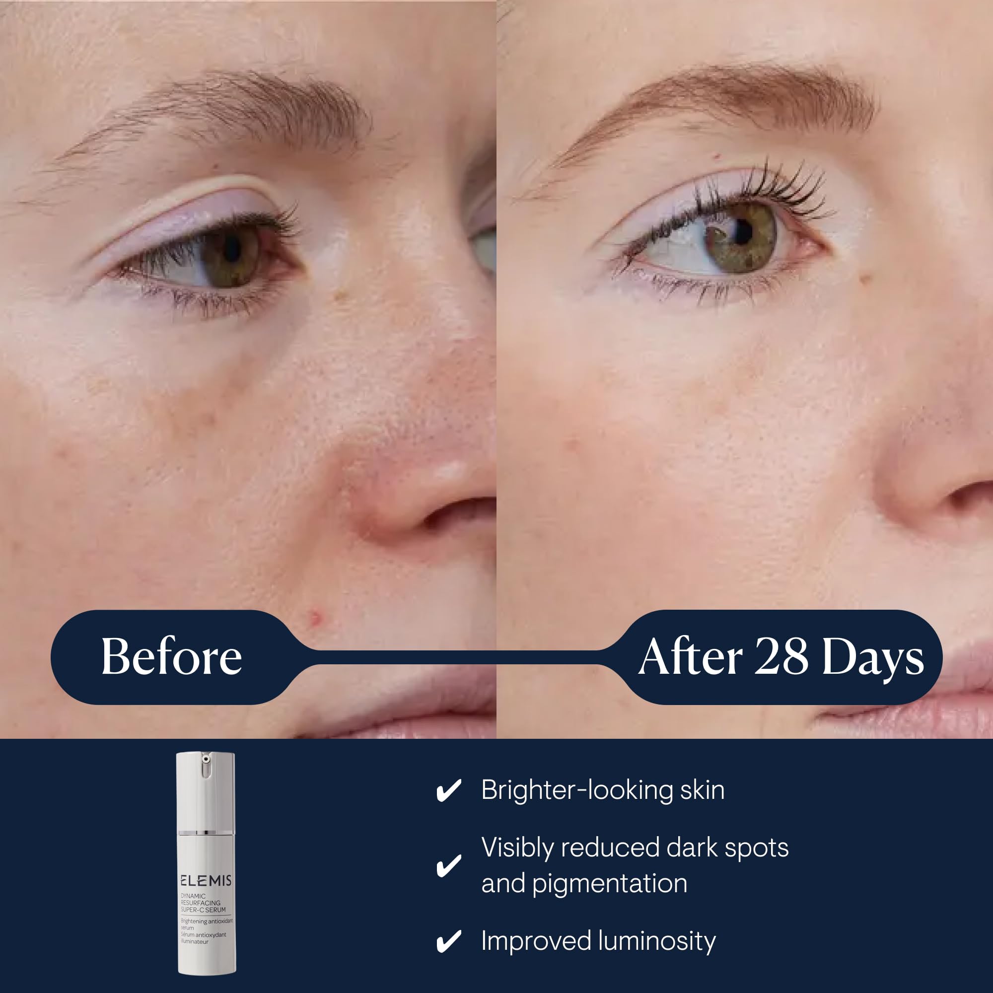 Elemis Dynamic Resurfacing Super-C Serum - Brightening Antioxidant Vitamin C | 30ml