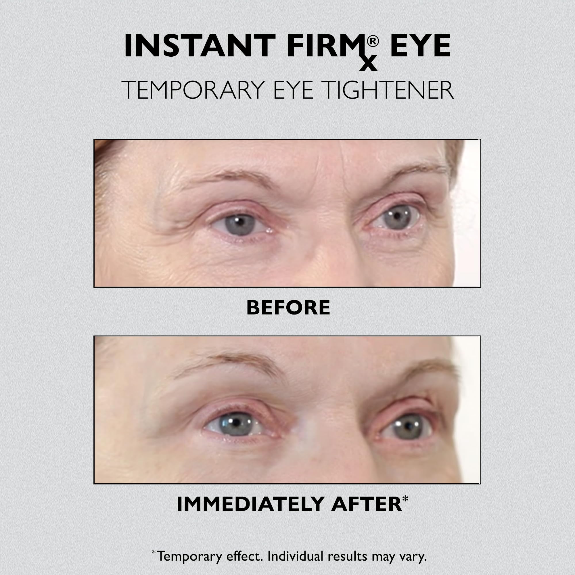 Peter Thomas Roth Instant FIRMx Eye Temporary Eye Tightener - Reduces Puffiness & Wrinkles | 15ml 6