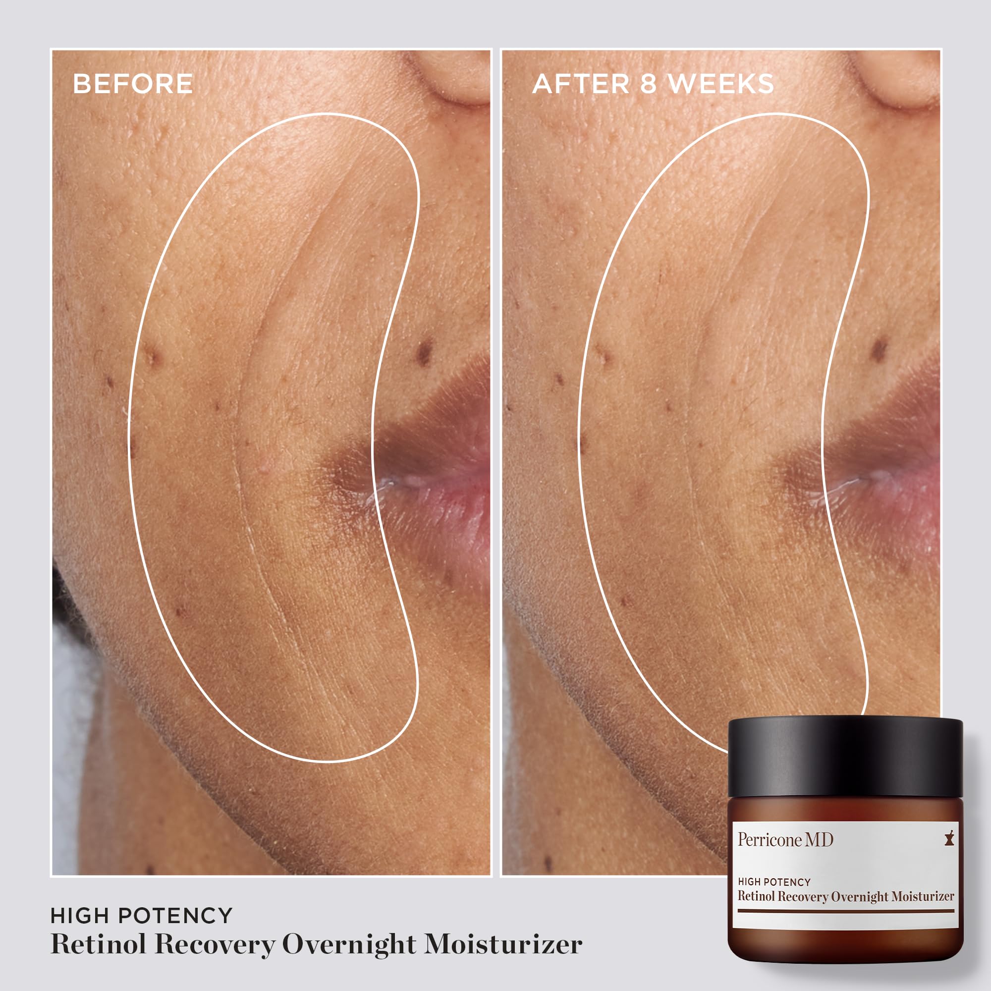 Perricone MD High Potency Retinol Recovery Overnight Moisturizer Cream 59 ml for Unisex Adult 3